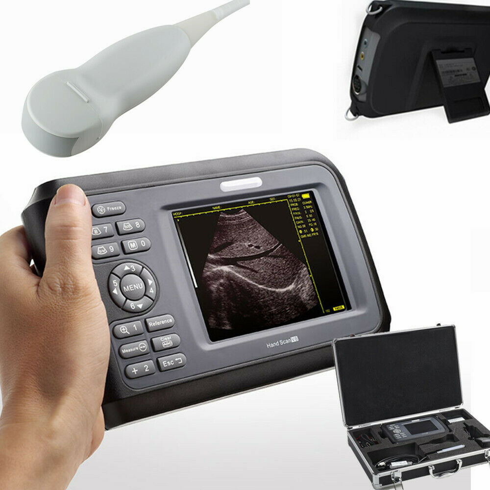 Newest Digital Handheld Ultrasound Machine Scanner+5Mhz Micro-Convex Human Use DIAGNOSTIC ULTRASOUND MACHINES FOR SALE