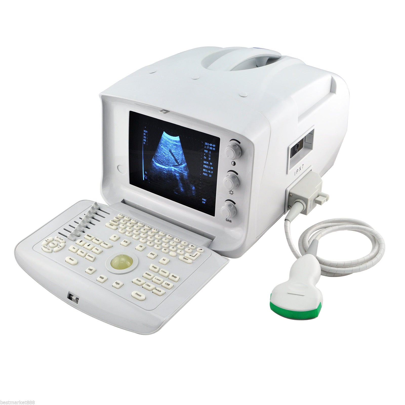 Carejoy Veterinary Full Digital Ultrasound Scanner +7.5MHz Rectal Probe Animals DIAGNOSTIC ULTRASOUND MACHINES FOR SALE