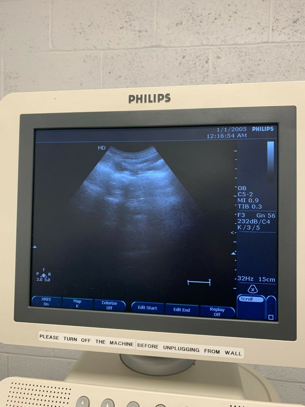 Philips HD7XE Ultrasound System (DOM: July 2010) w/ C5-2 Transducer Probe DIAGNOSTIC ULTRASOUND MACHINES FOR SALE