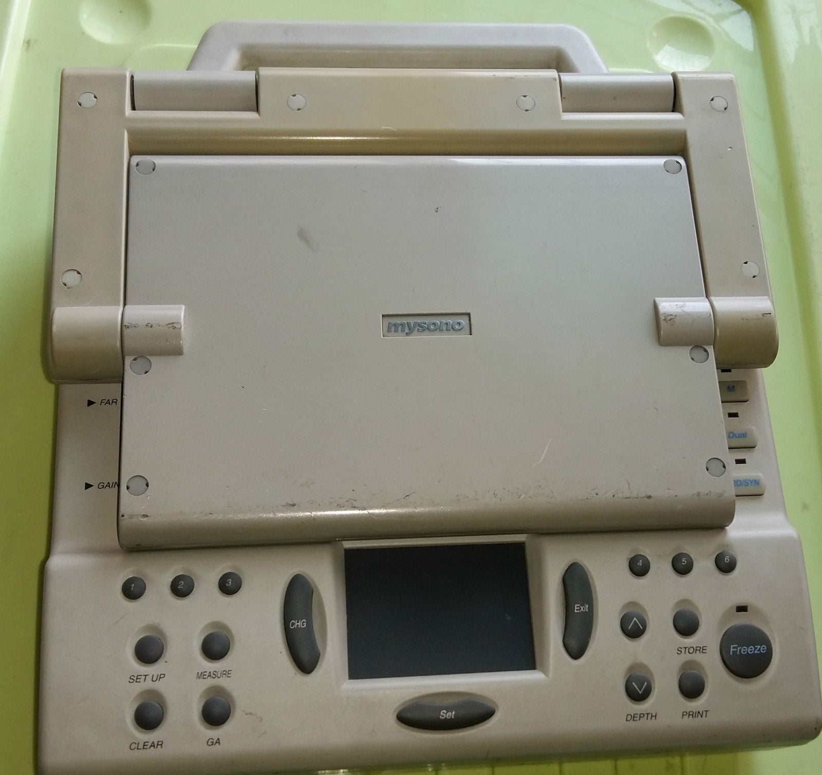 Medison / Samsung  mysono 201 personal digital ultrasound  / Parts DIAGNOSTIC ULTRASOUND MACHINES FOR SALE