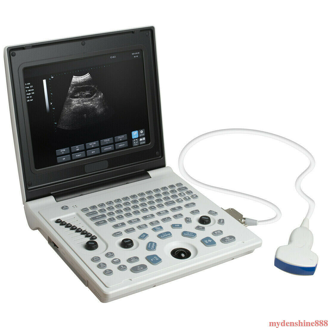 Portable 12" Full Digital Ultrasound Scanner Machine + 3.5MHz Convex Probe Human DIAGNOSTIC ULTRASOUND MACHINES FOR SALE