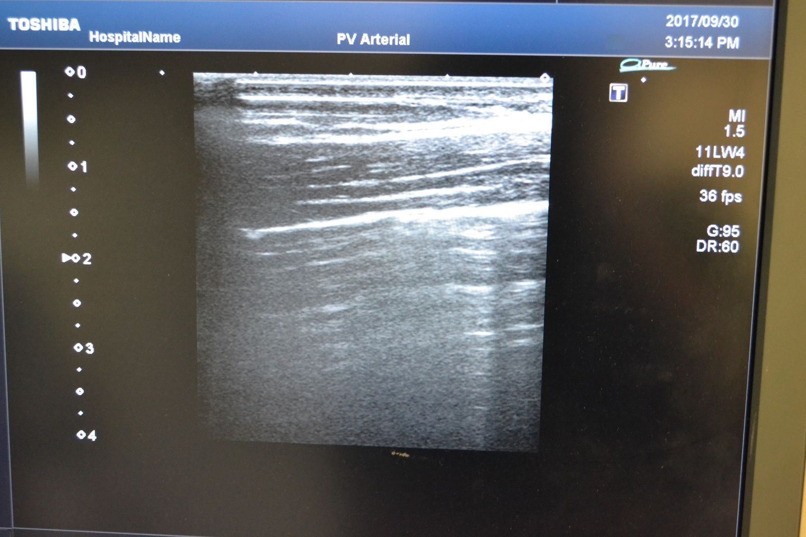 Toshiba Artida PLT-704SBT 11-4.8MHz Linear Ultrasound Transducer Probe  J1624 DIAGNOSTIC ULTRASOUND MACHINES FOR SALE