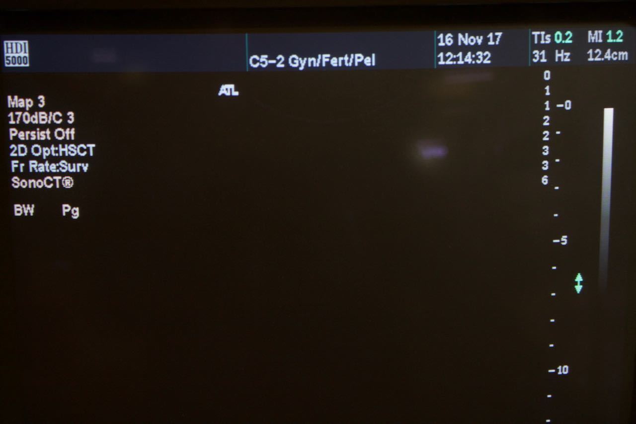 Philips ATL C5-2 40R Curved Array Ultrasound Transducer HDI5000 4000-0574-05 DIAGNOSTIC ULTRASOUND MACHINES FOR SALE