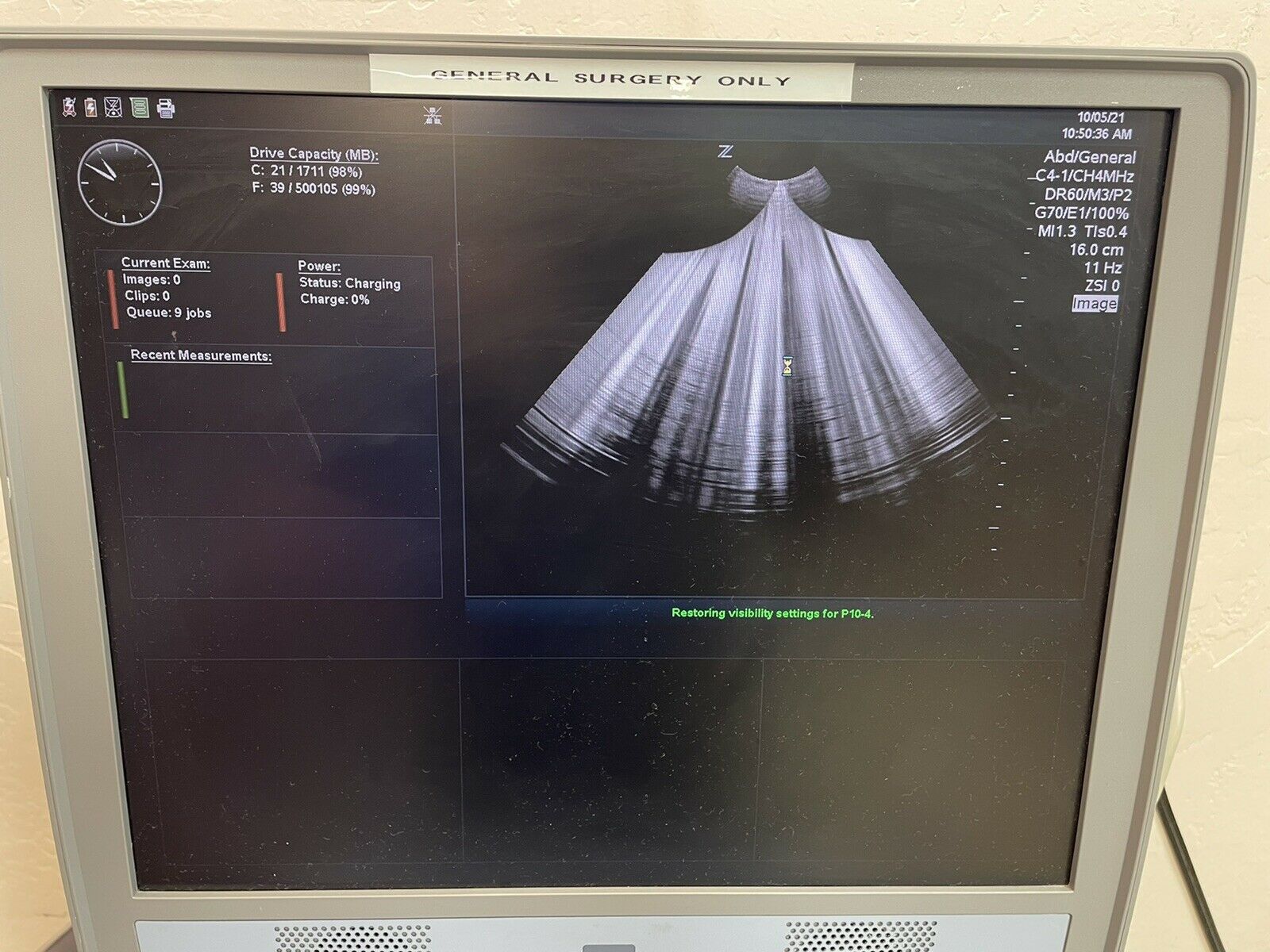 Zonare Z One Ultrasound System With Transducer And Printer DIAGNOSTIC ULTRASOUND MACHINES FOR SALE