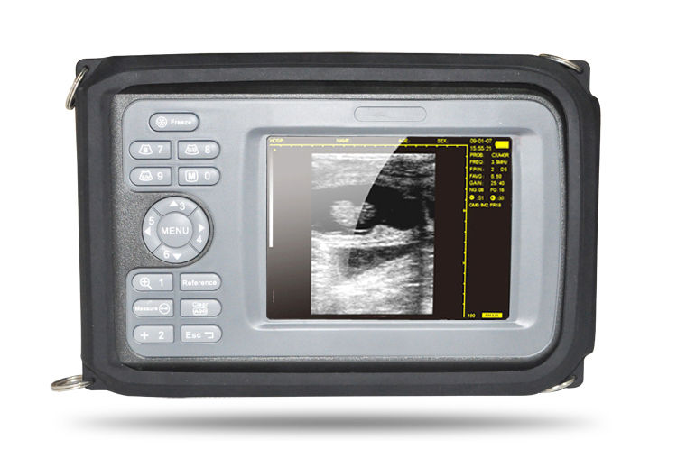 USA Big 5.5" Portable Diagnostic Ultrasound Machine Scanner System Convex Probe DIAGNOSTIC ULTRASOUND MACHINES FOR SALE