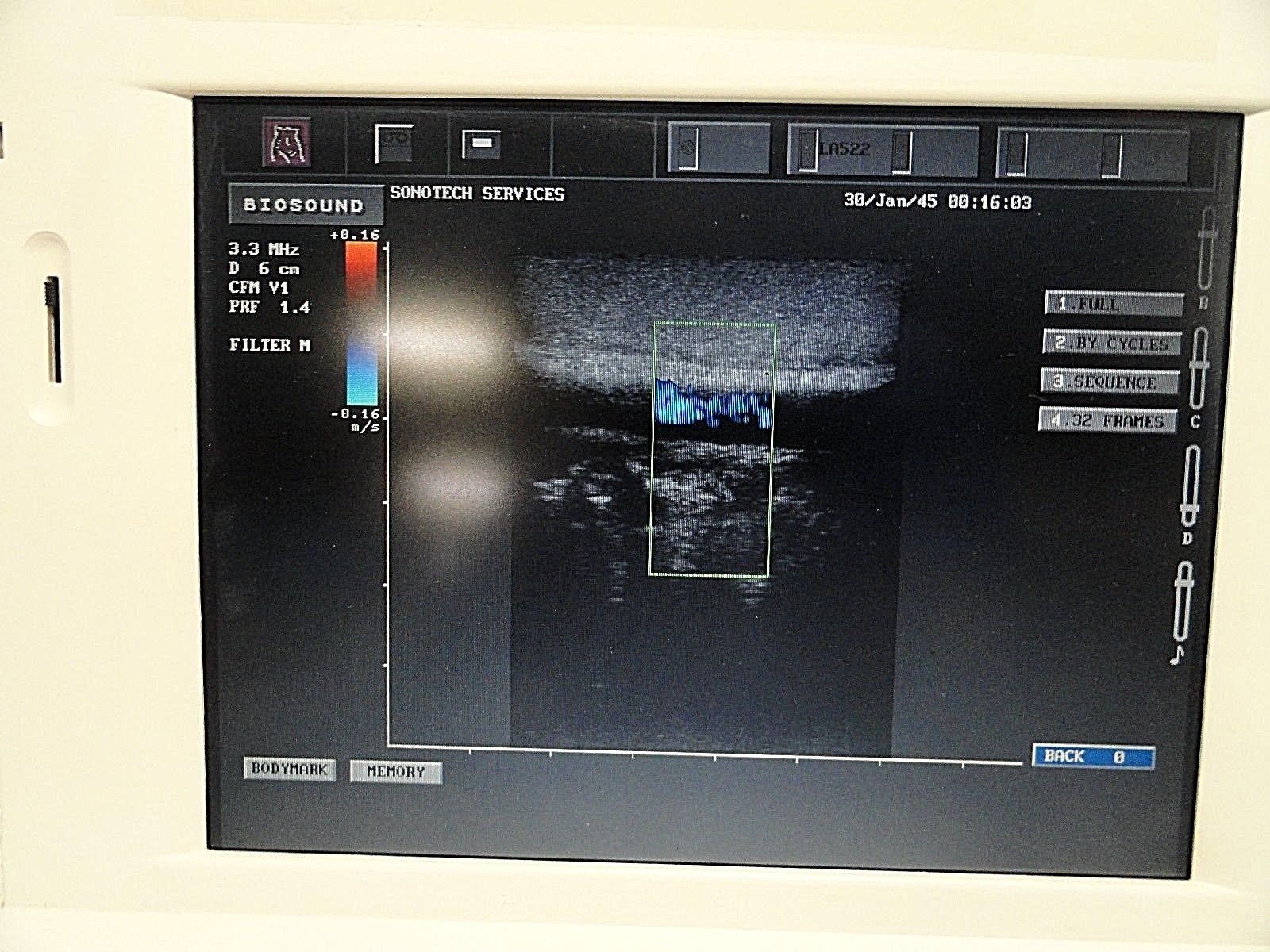 Biosound ESAOTE LA522E Linear Array Ultrasound Transducer W/ Case~14899 DIAGNOSTIC ULTRASOUND MACHINES FOR SALE