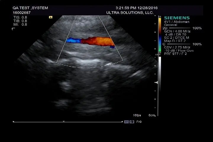 Siemens S2000 Ultrasound System DIAGNOSTIC ULTRASOUND MACHINES FOR SALE