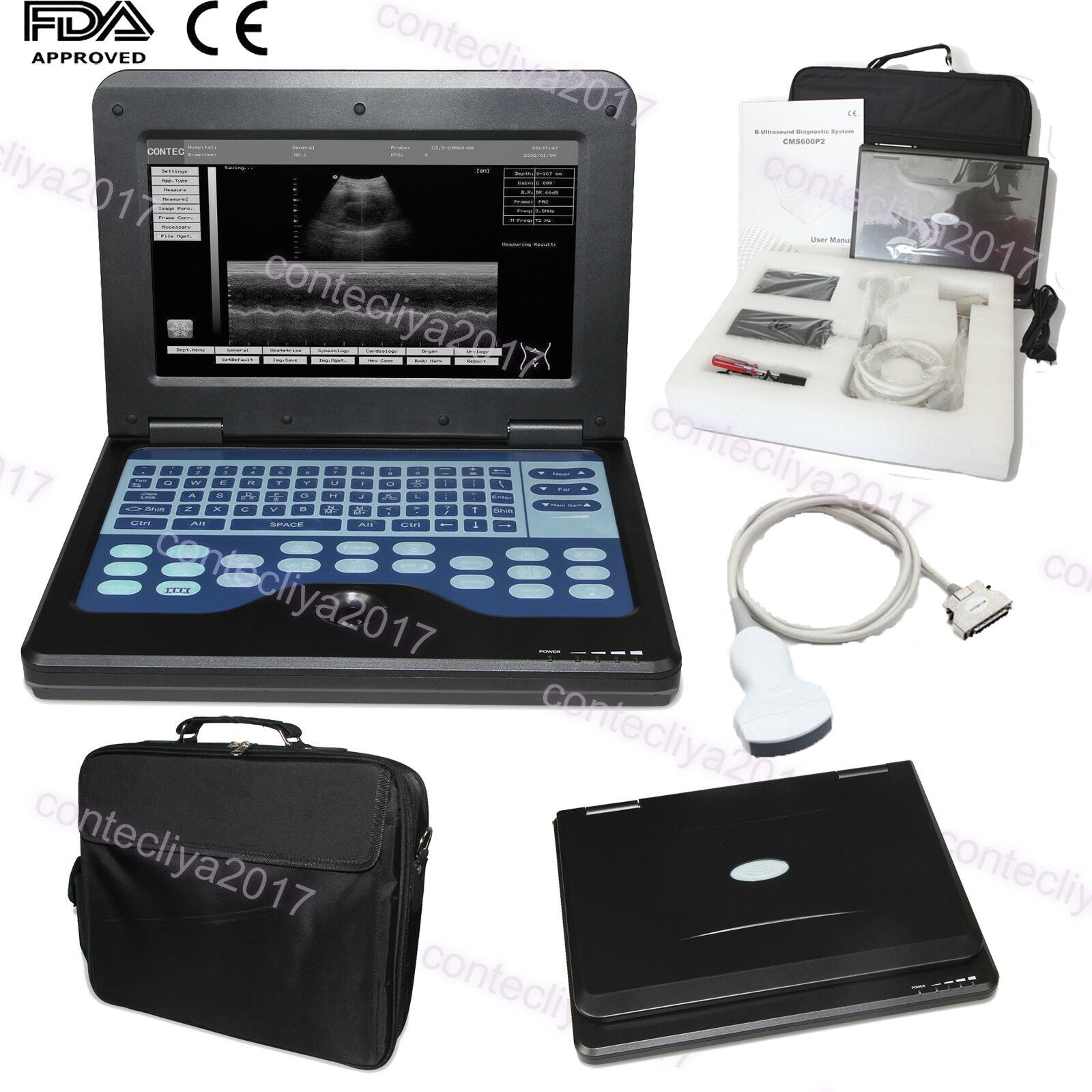 US Sell New Portable Laptop Ultrasound Scanner Machine Digital Convex For Human DIAGNOSTIC ULTRASOUND MACHINES FOR SALE