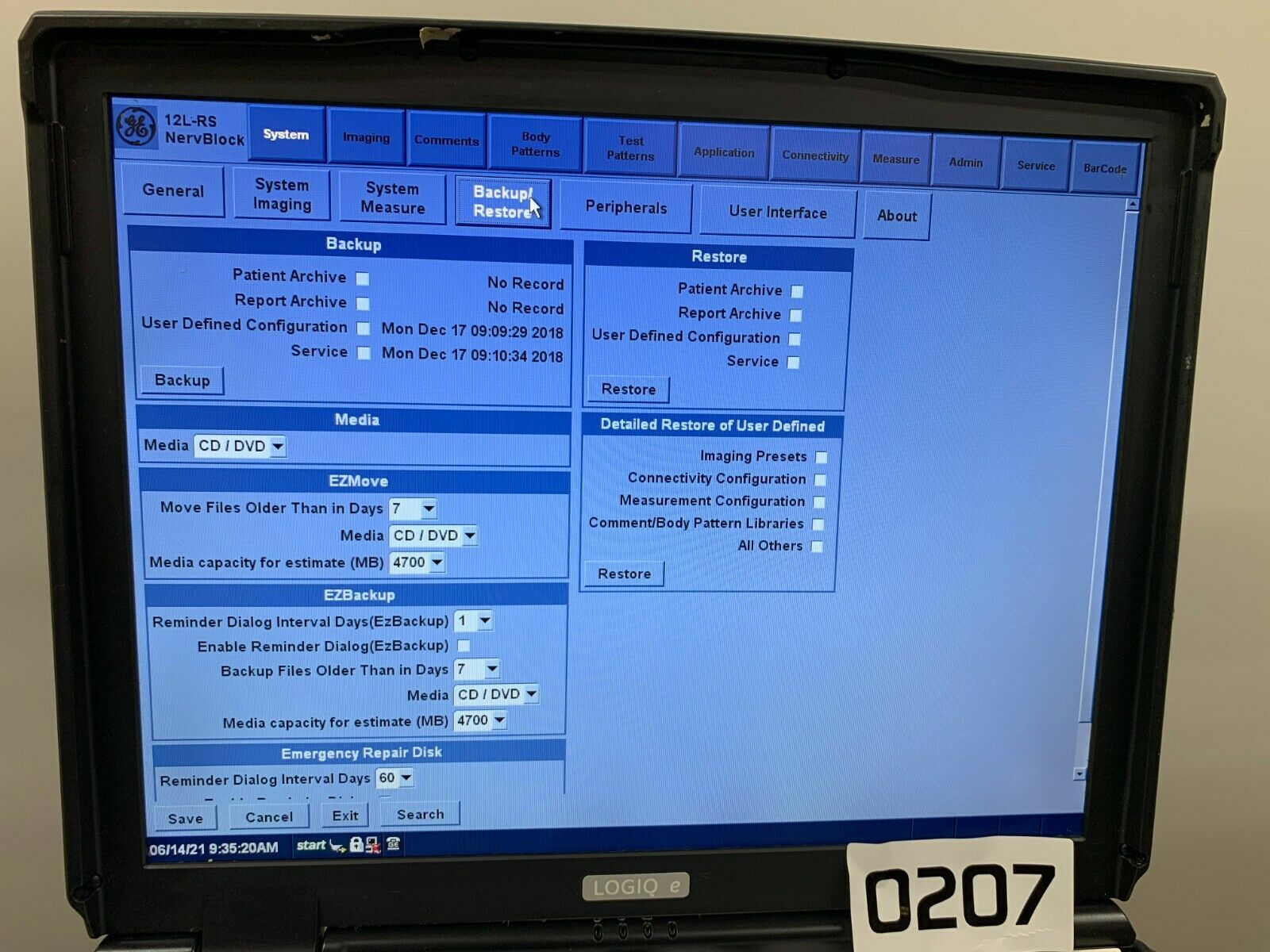 GE Logiq e NextGen Portable Ultrasound 5419804 W/12L-RS Probe V R7.0.3 0207 DIAGNOSTIC ULTRASOUND MACHINES FOR SALE