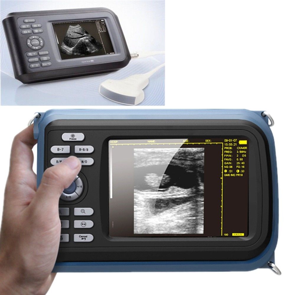 US Ship Diagnostic Ultrasound Scanner Machine Convex Probe+Pulse Oximeter Clinic DIAGNOSTIC ULTRASOUND MACHINES FOR SALE