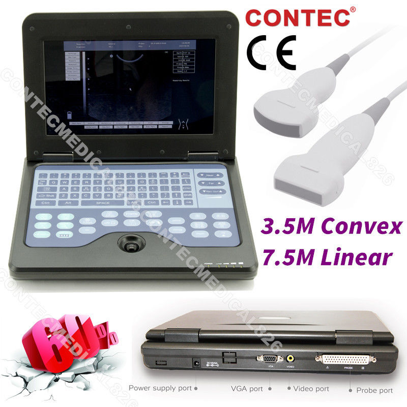 CE Portable Ultrasound Scanner Laptop Machine Diagnostic System Optional 4 Probe DIAGNOSTIC ULTRASOUND MACHINES FOR SALE