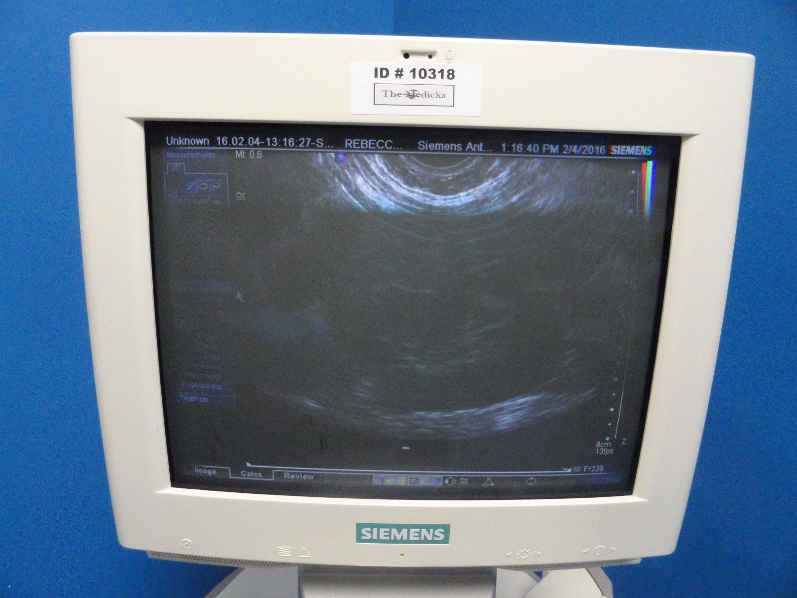 2005 Siemens Sonoline Antares Ultrasound W/ EC9-4 & VF13-5 Transducers (10318) DIAGNOSTIC ULTRASOUND MACHINES FOR SALE