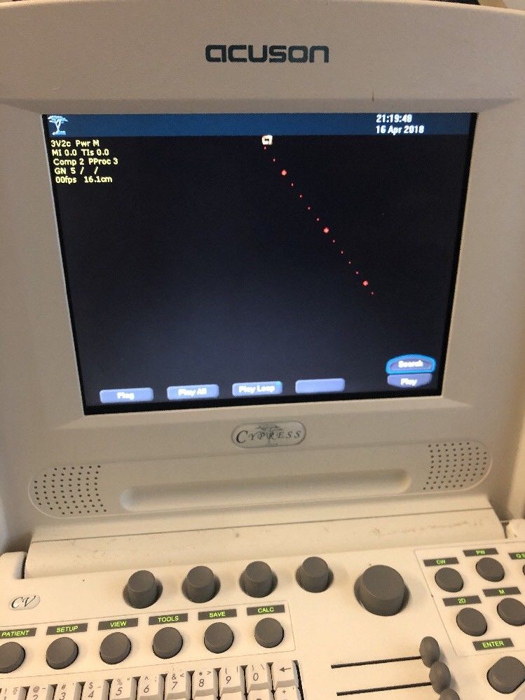 SIEMENS  Acuson Cypress Ultrasound Machine with 3V2c probe DIAGNOSTIC ULTRASOUND MACHINES FOR SALE