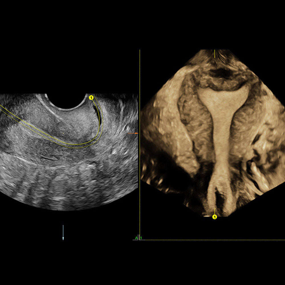 Voluson E6 GE Ultrasound System - Excellent 3D/4D Imaging Machine HD LIVE BT13 DIAGNOSTIC ULTRASOUND MACHINES FOR SALE