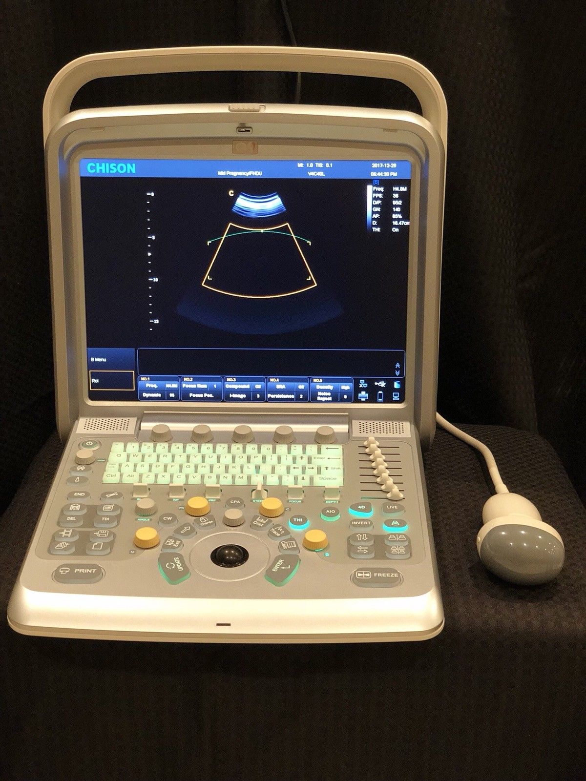 Chison Q9 Ultrasound Machine 2D 3D 4D with VirtualHD Perfect Baby Studio Setup DIAGNOSTIC ULTRASOUND MACHINES FOR SALE