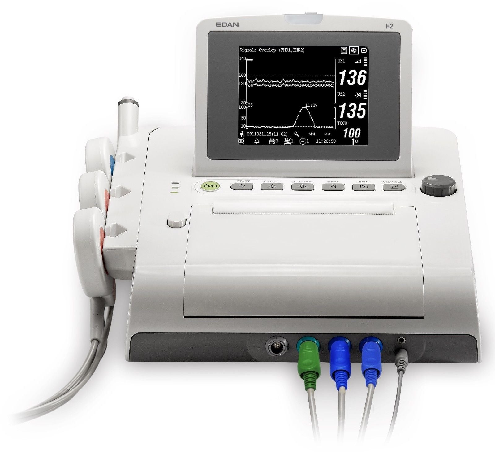 NEW ! EDAN F2 5.6" LCD Display Twin Fetal Heart Rate Monitor / FHR Monitor DIAGNOSTIC ULTRASOUND MACHINES FOR SALE