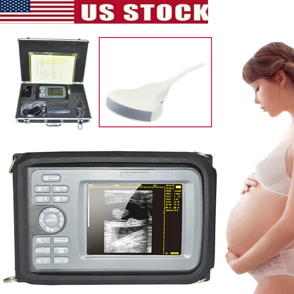 Portable Handheld Ultrasound Scanner Machine Digital+Convex Probe For Human Tool DIAGNOSTIC ULTRASOUND MACHINES FOR SALE