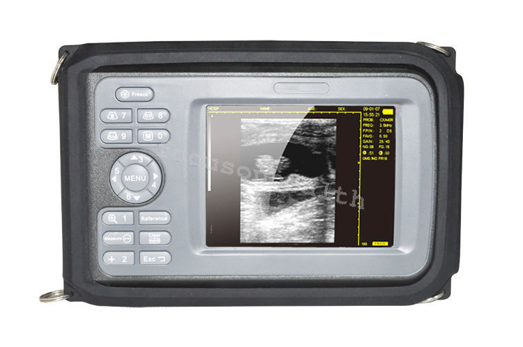 CE Mankind 5.5 Inch Digital Handheld LCD Ultrasound Scanner + Transvaginal Probe DIAGNOSTIC ULTRASOUND MACHINES FOR SALE