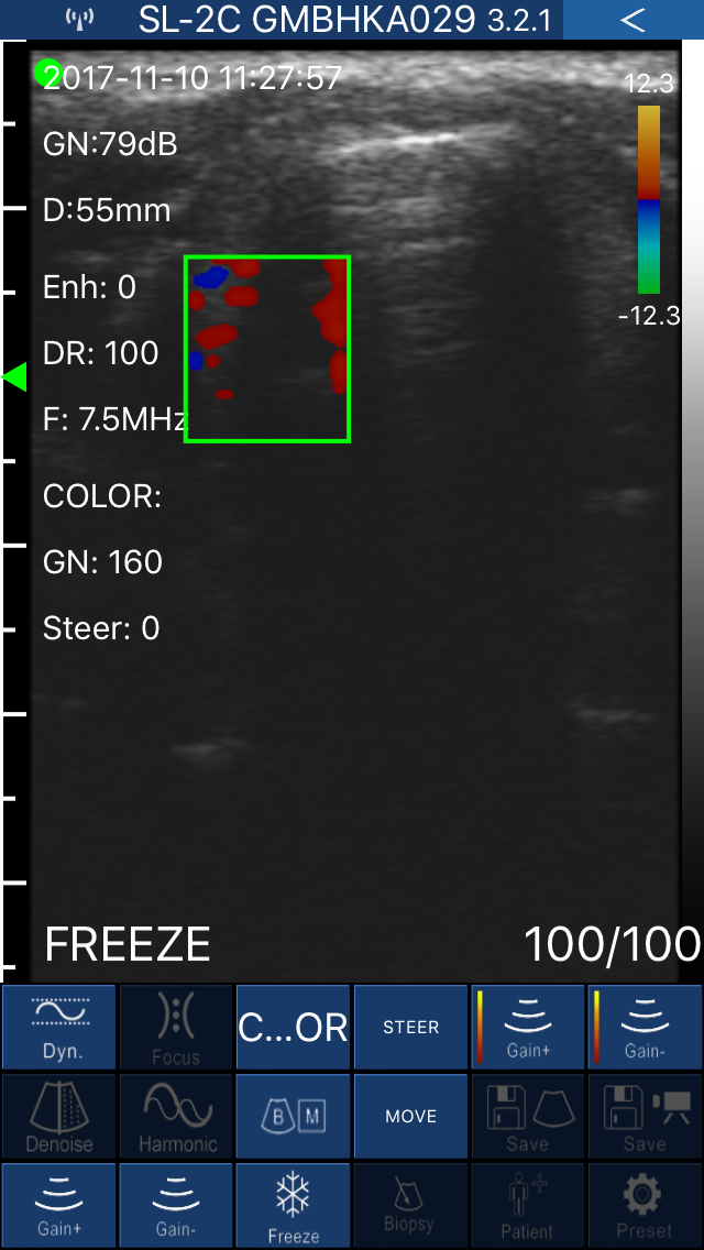 Wifi Ultrasound Color Doppler 7.5 MHz, discounted special DIAGNOSTIC ULTRASOUND MACHINES FOR SALE