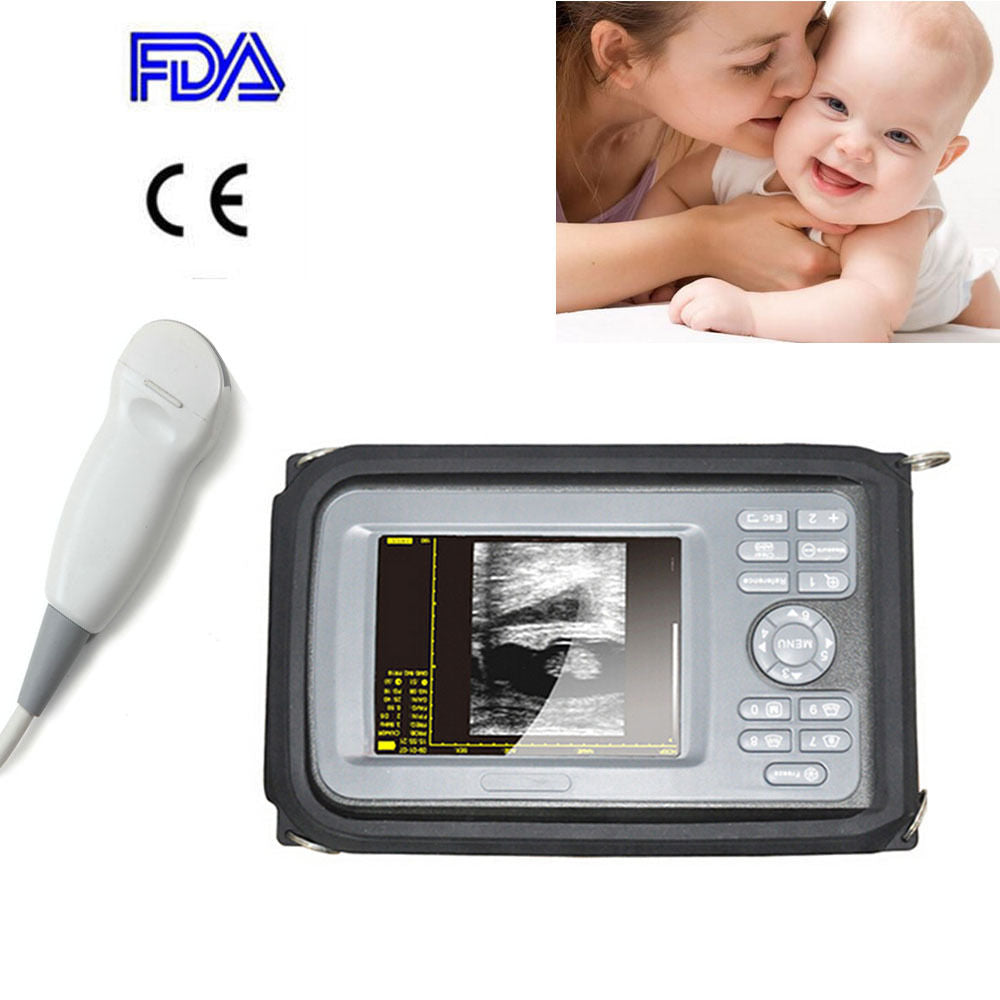 5.5 " Handheld Ultrasound Scanner/Machine  Digital Micro-convex Probe Human CE DIAGNOSTIC ULTRASOUND MACHINES FOR SALE