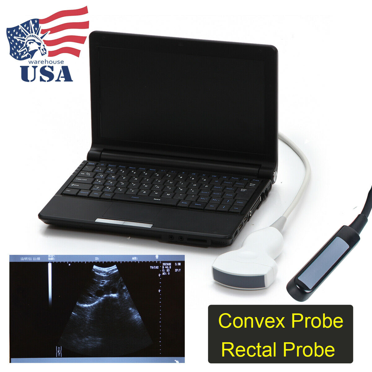 10" TFT Portable Digital Laptop Ultrasound Scanner Machine + Convex Rectal Probe DIAGNOSTIC ULTRASOUND MACHINES FOR SALE