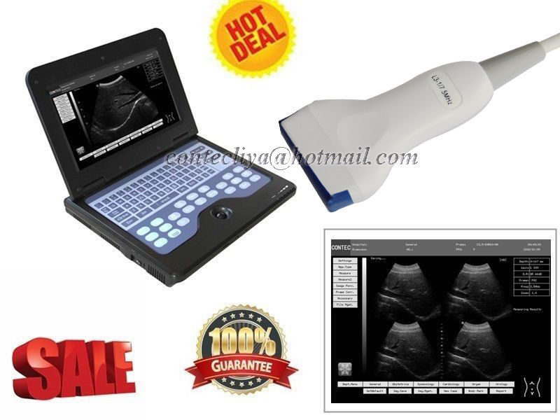 CE Digital Ultrasound Scanner Laptop Machine Diagnostic System Optional 4 Probe DIAGNOSTIC ULTRASOUND MACHINES FOR SALE