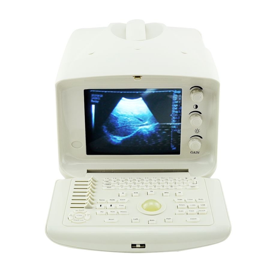 Vet Portable Ultrasound Scanner Machine Micro-Convex Probe 2 Probe CONNECTORS AA DIAGNOSTIC ULTRASOUND MACHINES FOR SALE