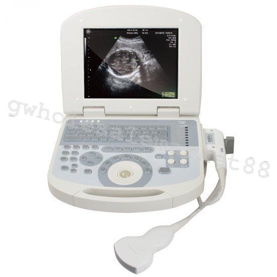 USA +3D Portable Machine Digital Ultrasound Scanner System 3.5MHZ Convex Probe DIAGNOSTIC ULTRASOUND MACHINES FOR SALE