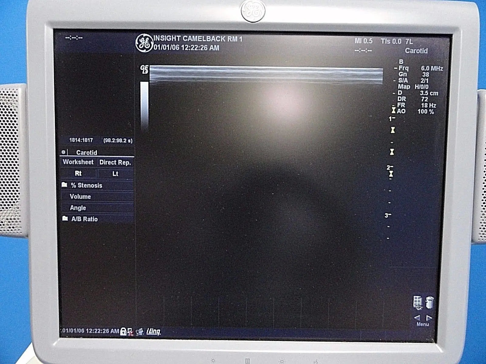 GE  7L / 2302648 Linear Array Ultrasound Probe for Logiq & Vivid Series~13787 DIAGNOSTIC ULTRASOUND MACHINES FOR SALE