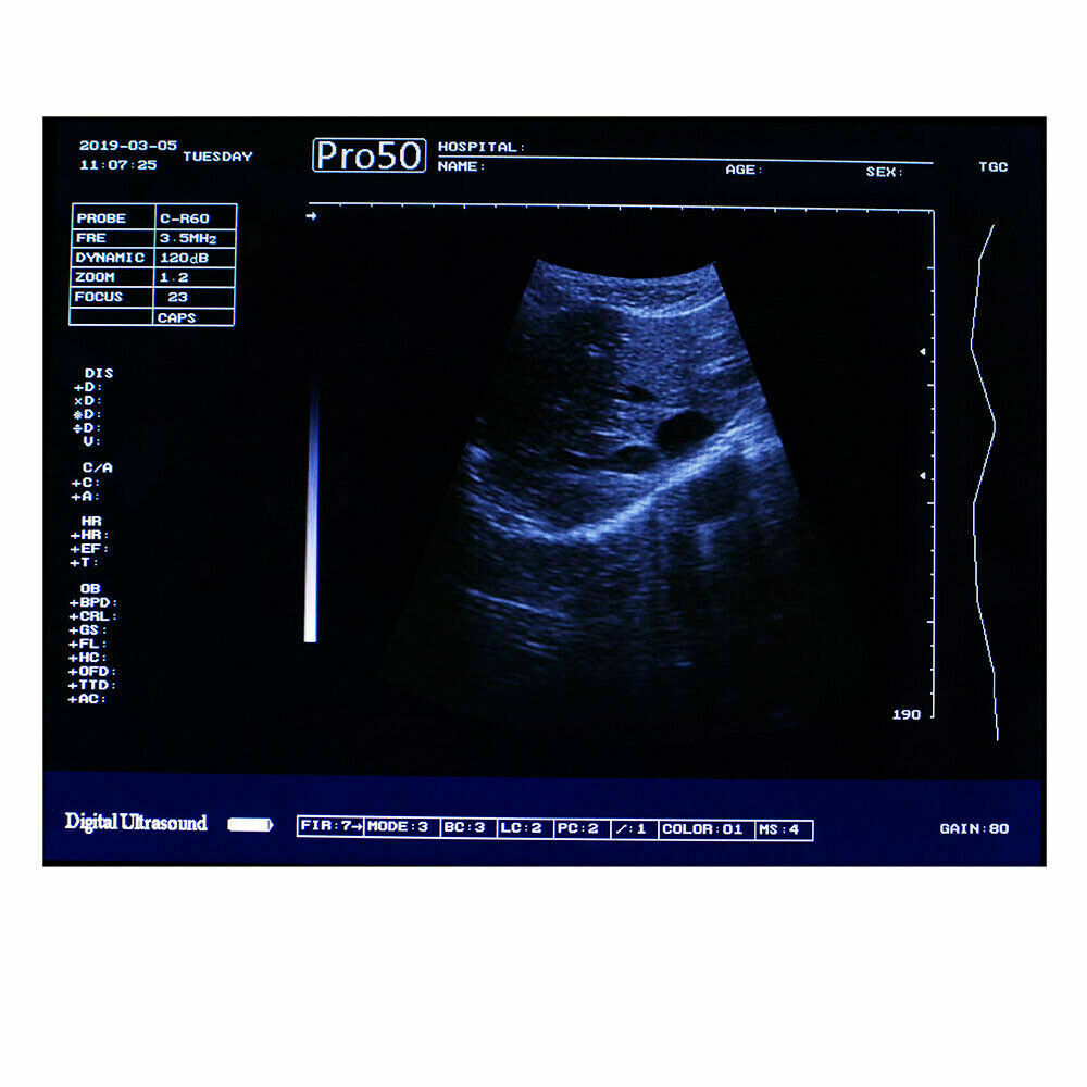 USA Full Digital Ultrasound Scanner Ultrasonic MachineDisgnos Convex Probe 3D CE DIAGNOSTIC ULTRASOUND MACHINES FOR SALE