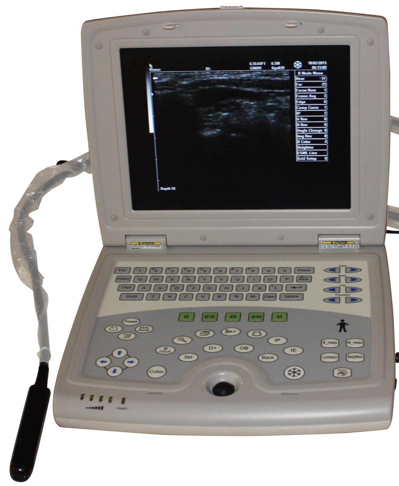 Veterinary Laptop - Animal Ultrasound Scanner - Bovine, Equine KeeboMed KX5000KV DIAGNOSTIC ULTRASOUND MACHINES FOR SALE