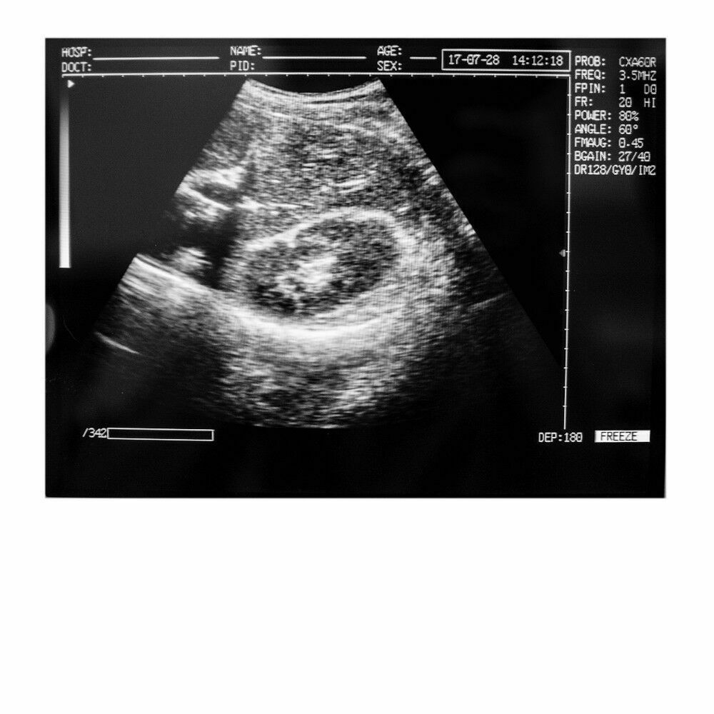 Portable Medical Digital Laptop Ultrasound Scanner Machine 3.5 Convex probe+3D DIAGNOSTIC ULTRASOUND MACHINES FOR SALE