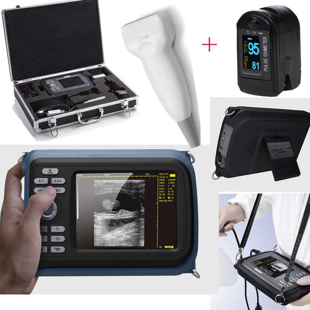 USA Human Handheld Digital Ultrasound Scanner Machine Linear Probe+Oximeter Case 190891044433 DIAGNOSTIC ULTRASOUND MACHINES FOR SALE