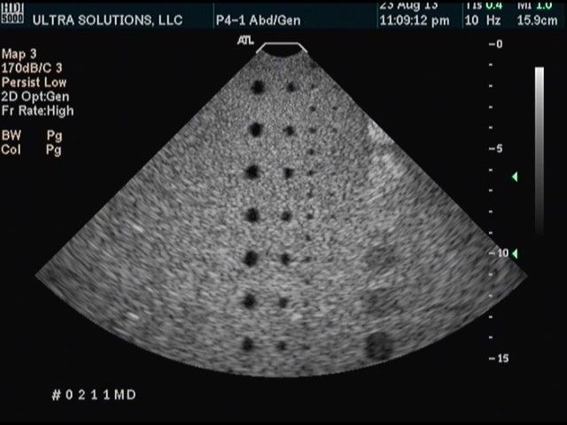 ATL P4-1 Ultrasound Probe DIAGNOSTIC ULTRASOUND MACHINES FOR SALE