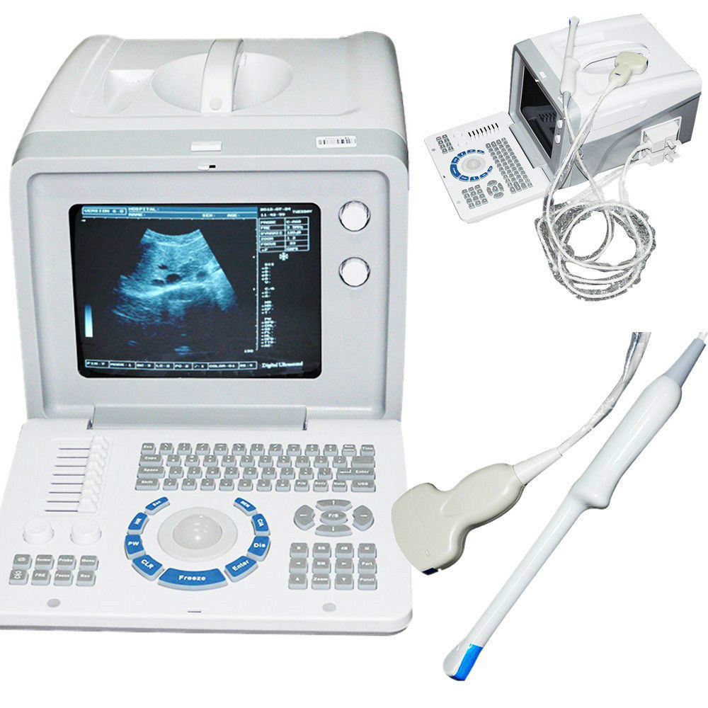 Ultrasound Scanner Machine Convex +Transvaginal 2 Probe 3D Pregnancy USB VGA New 190891422446 DIAGNOSTIC ULTRASOUND MACHINES FOR SALE