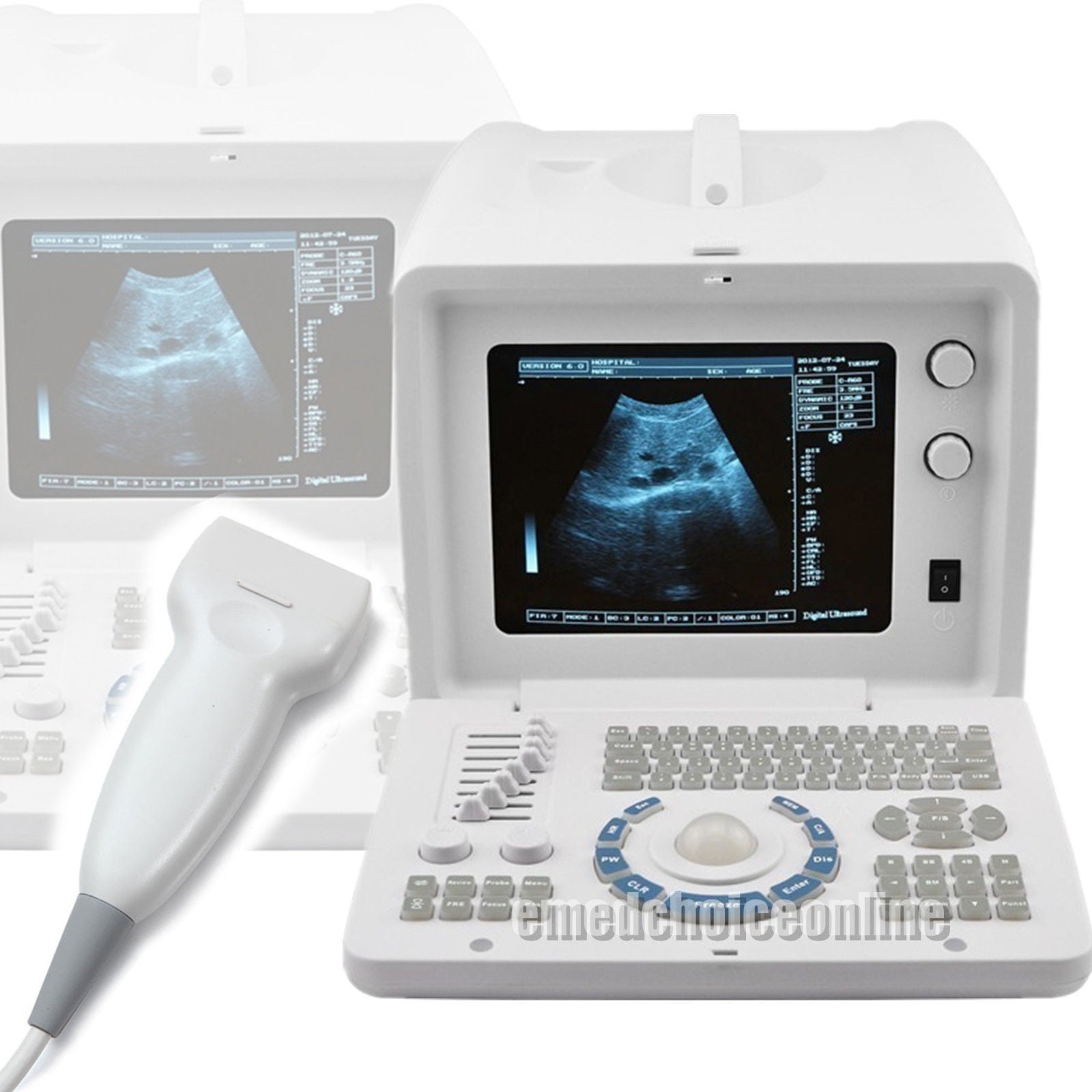 Super 3D Portable Ultrasound Scanner with 7.5 Linear Probe external 3D version DIAGNOSTIC ULTRASOUND MACHINES FOR SALE