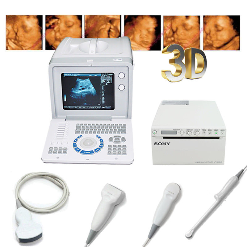 Ultrasound Scanner,Convex,Linear,Transvaginal,Mico-convex Probe,Terminal Printer 190891975614 DIAGNOSTIC ULTRASOUND MACHINES FOR SALE