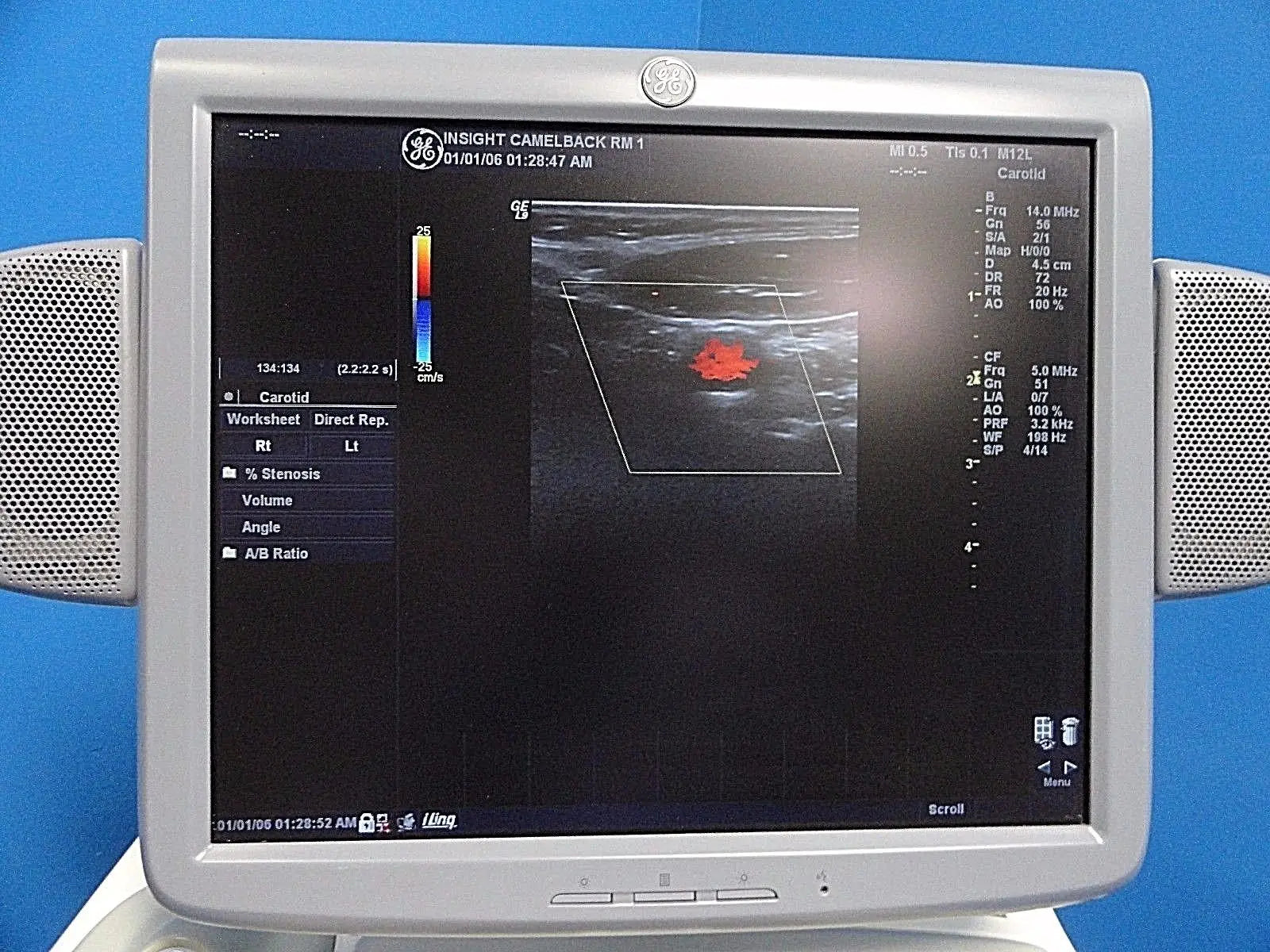 GE M12L P/N 2294512 Linear Array Ultrasound Probe for Logiq & Vivid Series~13722 DIAGNOSTIC ULTRASOUND MACHINES FOR SALE