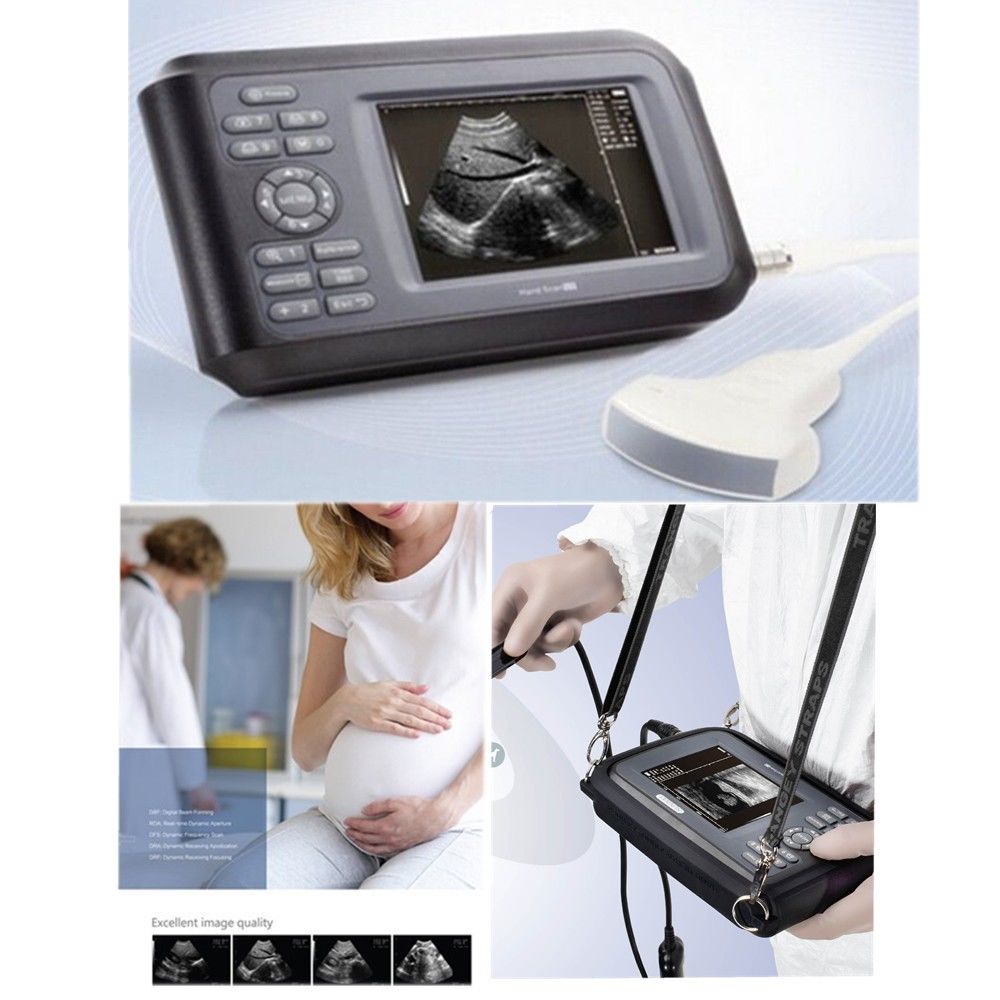 US Ship Diagnostic Ultrasound Scanner Machine Convex Probe+Free Pulse Oximeter DIAGNOSTIC ULTRASOUND MACHINES FOR SALE