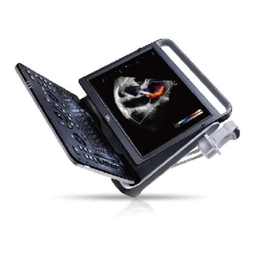 Chison eBit 60 Color Doppler Ultrasound Scanner & Cardiac CW, Vascular 7-18MHz DIAGNOSTIC ULTRASOUND MACHINES FOR SALE