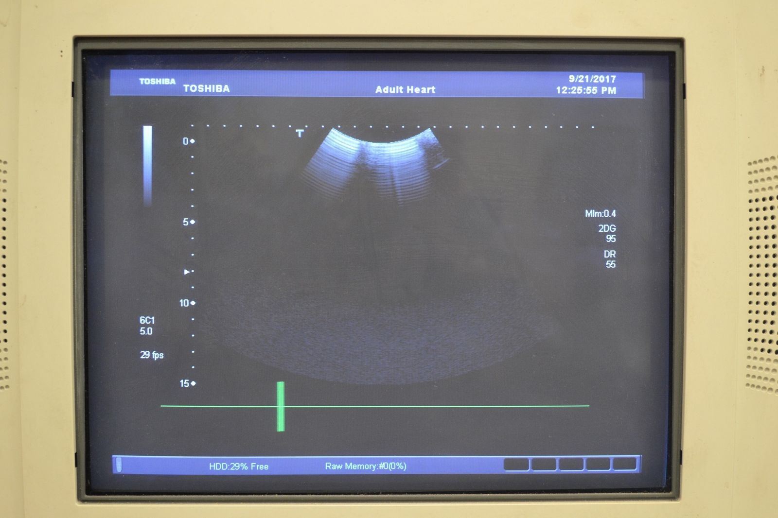 Toshiba Aplio 500 PVT-375BT 6-1.9MHz Convex Ultrasound Transducer Probe DIAGNOSTIC ULTRASOUND MACHINES FOR SALE