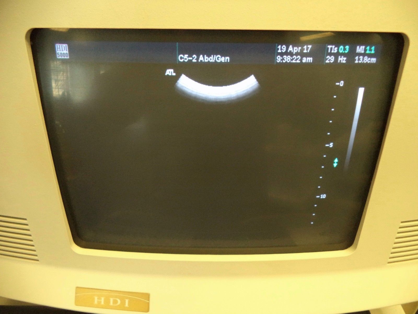 ATL HDI 5000 CV Ultrasound w/ 3 Probes DIAGNOSTIC ULTRASOUND MACHINES FOR SALE