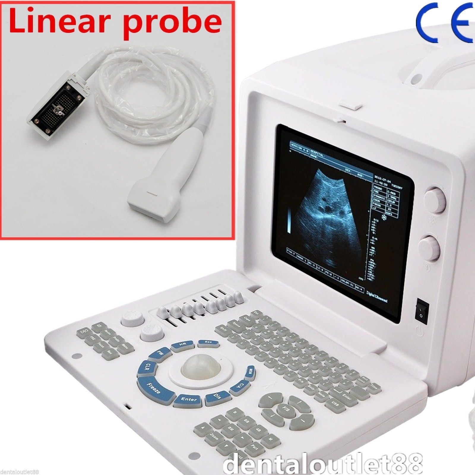 Top 10''Ultrasound Scanner ultrasonic System with Linear Probe+3D Software SVGA DIAGNOSTIC ULTRASOUND MACHINES FOR SALE