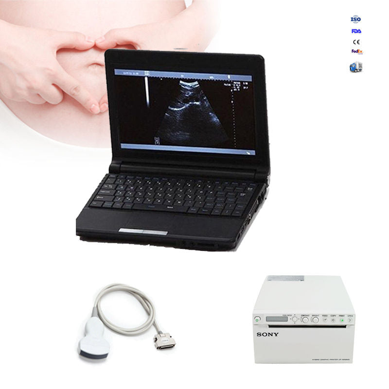 SONY Terminal Printer + Digital Ultrasound Scanner Notebook +Convex Probe +3D 190891974488 DIAGNOSTIC ULTRASOUND MACHINES FOR SALE