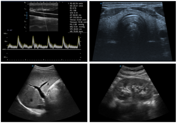 SonoScape A6V Expert (E1V) Veterinary Ultrasound & large animals rectal Probe DIAGNOSTIC ULTRASOUND MACHINES FOR SALE