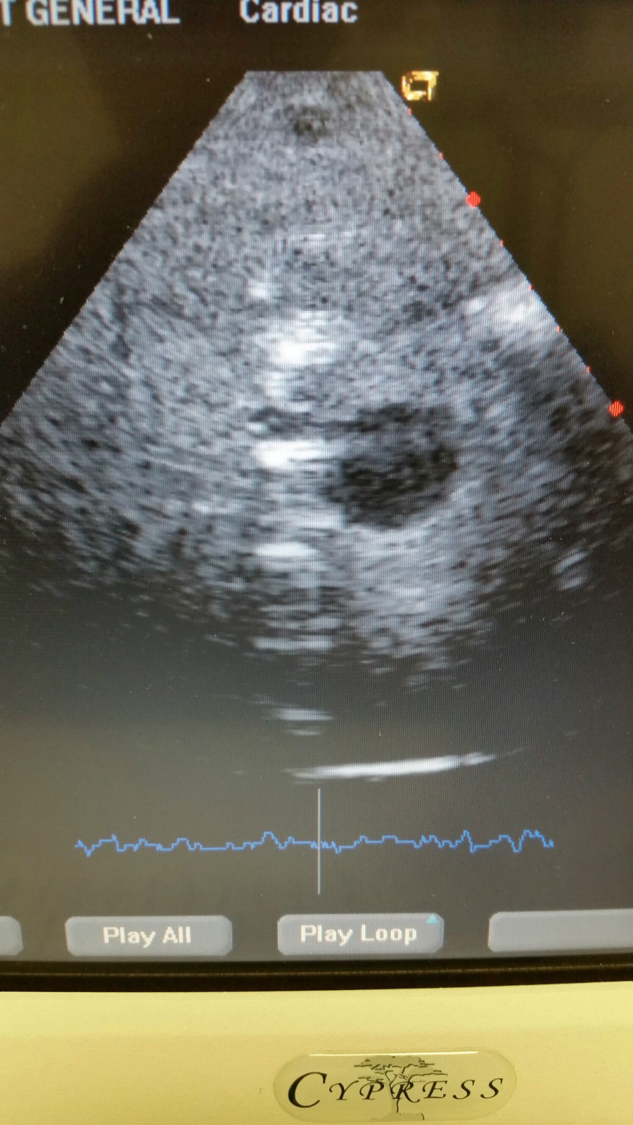 Acuson Cypress Cardiac Vascular Ultrasound Machine Rev 14 + CW, 3V2c, 7L3 Probe DIAGNOSTIC ULTRASOUND MACHINES FOR SALE