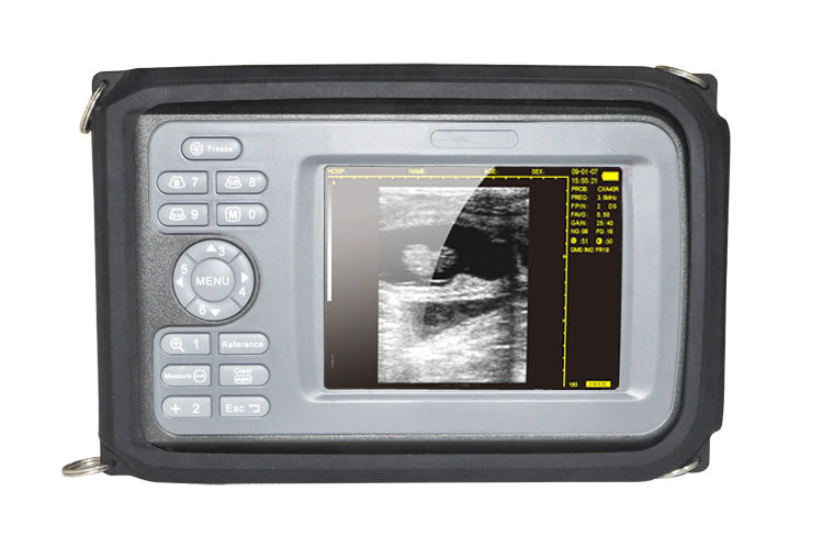 Veterinary Digital Handheld Ultrasound Scanner Machine+Rectal Probe Pet Battery DIAGNOSTIC ULTRASOUND MACHINES FOR SALE