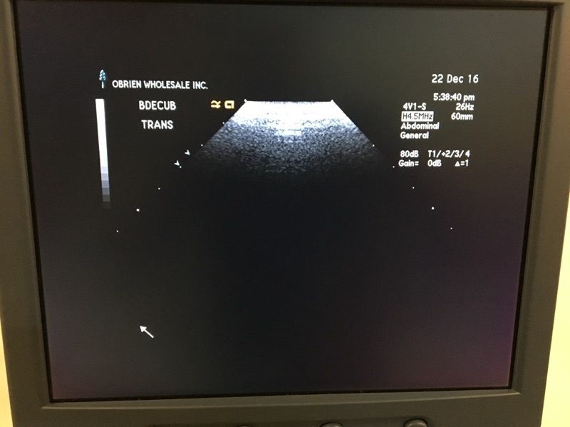 Siemens Sequoia Acuson 512 Cardiac Ultrasound w/ 4V1 6C2 EV-8C4 Transducer DIAGNOSTIC ULTRASOUND MACHINES FOR SALE