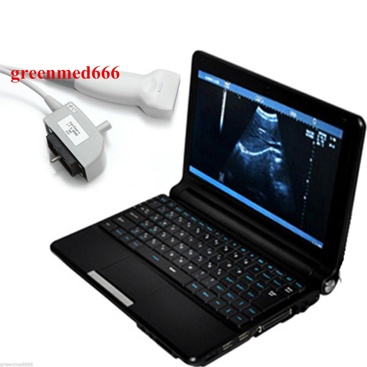 7.5M Linear Probe  Full Digital Diagnostic System Ultrasound Scanner Machine New 190891735249 DIAGNOSTIC ULTRASOUND MACHINES FOR SALE