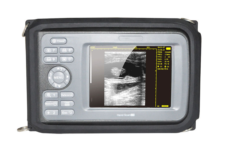 Portable Veterinary Digital Ultrasound Scanner Machine Animal Rectal Probe sale DIAGNOSTIC ULTRASOUND MACHINES FOR SALE